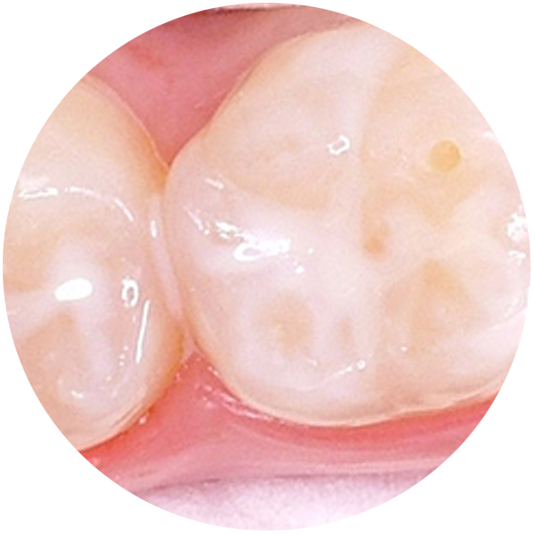 Preventative & Hygiene