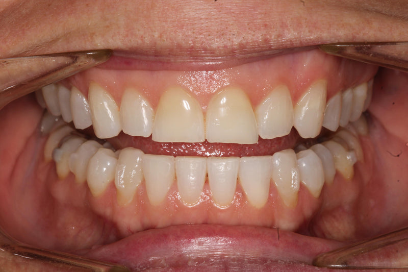 Load image into Gallery viewer, Modern Aesthetic Dentistry:  From Digital Planning to Advanced Composite Excellence (06-12)
