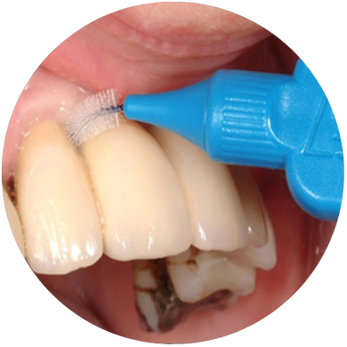 Interdental Cleaning & Specialized Toothbrushes