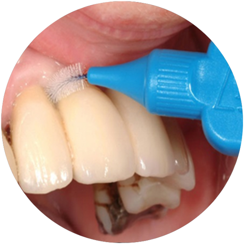 Interdental Cleaning & Specialized Toothbrushes