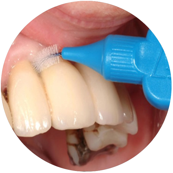 Interdental Cleaning & Specialized Toothbrushes