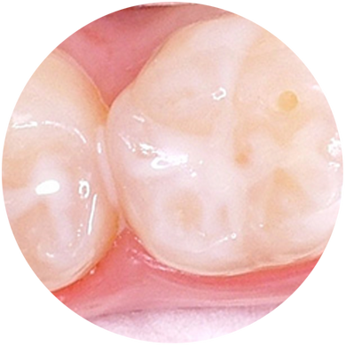 Preventative & Hygiene