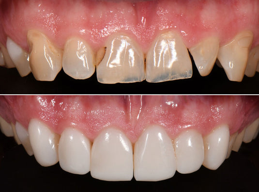 Advanced Masterclasses with the Bioclear Method (13/14)